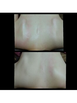 ビューティースリム タニダ/