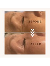 小顔フェイスラボ 鈴鹿店(小顔FaceLabo.)/◆目元の小じわ改善◆