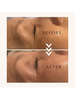 小顔フェイスラボ 鈴鹿店(小顔FaceLabo.)/◆目元の小じわ改善◆