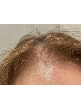 1回ごとにお支払い可能なサロン