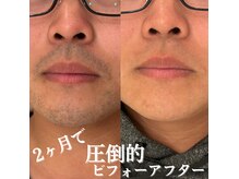 貸切空間/都度払い/全身脱毛/メンズ脱毛/VIO/ヒゲ/ワックス/眉毛