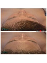 ローズムーン(Rose.Moon)/3Dコルギ×石膏パック