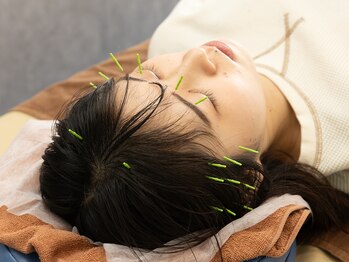 きくのだい鍼灸院の写真/【眼精疲労・頭の重だるさに】首肩から整える極上鍼×手技。疲れをリセットしスッキリ♪小顔に美容鍼も◎