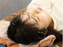 きくのだい鍼灸院