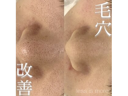 レスイズモア 恵比寿(less is more.)の写真