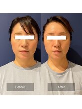 フフラ KANコルギセラピー山梨本店(fufla)/小顔ソムリエ