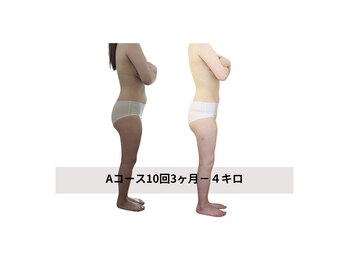 フレクシー/Aコース10回３か月の結果　痩身