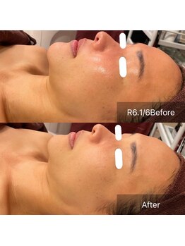 サンベリーナ(Thumbelina)/