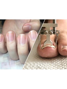 爪の悩みを解消できる（ケア含む）
