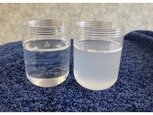 ステッラ(STELLA☆)/毛穴洗浄　Before/After