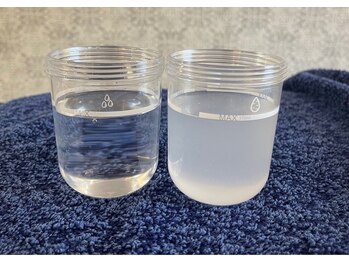 ステッラ(STELLA☆)/毛穴洗浄　Before/After