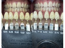 トウキョースワーズ 渋谷店(TOKYO SWRS)/#ホワイトニング #渋谷 #池袋