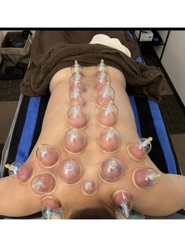 パンダてもみ本舗/吸い玉でスッキリ◎