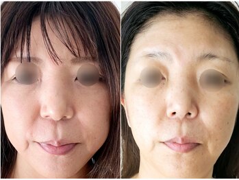 ディーバ 北浜(Diva)/二重アゴで悩まない小顔へ！