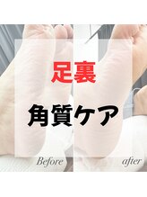 プリンセスローズ 焼津店(Princess Rose)/▼▼▼角質ケア▼▼▼