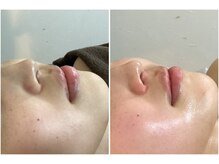 アイズ 横浜店(ize)/