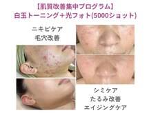 ラシク(LASHIQ)の雰囲気（肌別5000ショット照射！従来の光フェイシャルを超える高い満足度）
