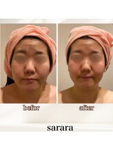 ナチュラル ビューティー スタイル さらさ(Natural Beauty Style)/お顔の土台から根本改善