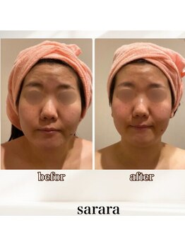 ナチュラル ビューティー スタイル さらさ(Natural Beauty Style)/お顔の土台から根本改善