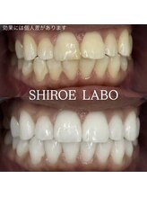 シロエラボ 梅田店/before after