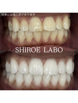 シロエラボ 梅田店/before after