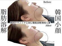 エステティック リベル キョウト 京都駅前店(Esthetic Liber Kyoto)/韓国小顔コルギ×脂肪分解