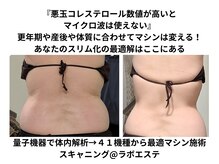 スキャニング@ラボエステ