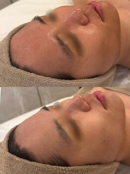 セレニテ(Serenite)/