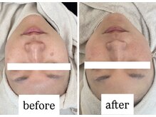 クロア ナゴヤ(Croire NAGOYA)の雰囲気（驚異のスペック☆プレミアム光フォト/シミケア/毛穴/たるみ）