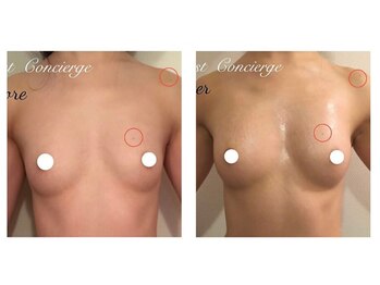 スマイルクルー(SmileClue)/ビフォーアフター症例