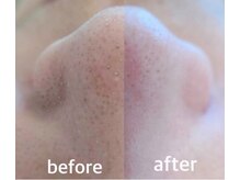 ネムレル森(Nemureru森)の雰囲気(毛穴汚れを除去し肌質を改善!化粧ノリUP♪毛穴レスな美肌へ★★)