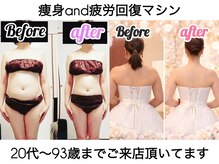サロン ド シスター(SALON de SISTER)の雰囲気（深部から温めローラーでしっかりお肌のボコボコをスッキリ）