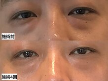 ルナ クレッシェンテ(Luna crescente)/目元ケアは若見えの第一歩