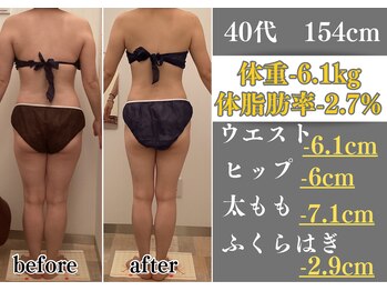 ラ コンシェル 町田店/Before After【町田店】