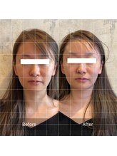 フフラ KANコルギセラピー山梨本店(fufla)/小顔ソムリエ