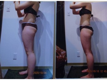 パーフェクトボディプレミアム 札幌駅前店(PERFECT BODY PREMIUM)/お客様　ビフォーアフター（20）