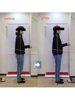 ホネツギ 柏駅西口接骨院(HONETSUGI)/【猫背矯正】before/after