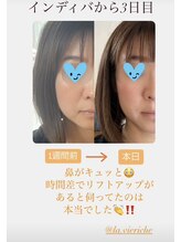 ラ ヴィ リッシュ(La vie riche)/初faciaから3日後のビフォアフ★