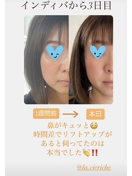 ラ ヴィ リッシュ(La vie riche)/初faciaから3日後のビフォアフ★