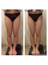 ミエル(Miel)/Before After
