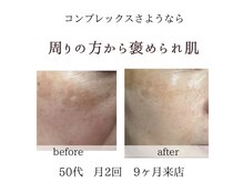 キラリ(kirari)/素敵なお客様のご感想｜肌質改善