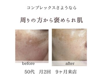 キラリ(kirari)/素敵なお客様のご感想｜肌質改善