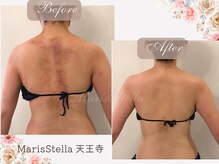 マリスステラ 天王寺(MarisStella)/1ヶ月以内の変化！