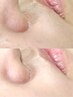 【鼻】極上つるすべ肌へ!トーンアップフェイスワックス