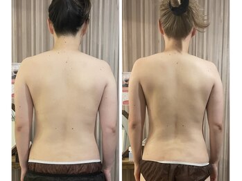 リムアール(Limh R)/