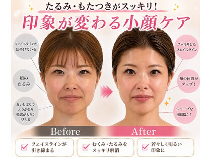 チェイル(JEIL)の写真
