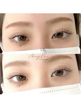 アマリリス(Amaryllis)/