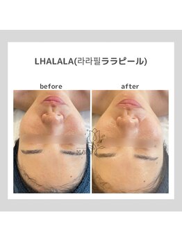 ポムハヌル(pom.haneul)/韓国肌管理室