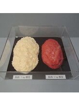 サロンドベル(salon de Belle)/脂肪と筋肉の差