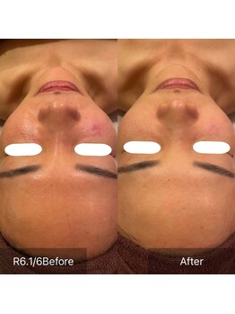 サンベリーナ(Thumbelina)/